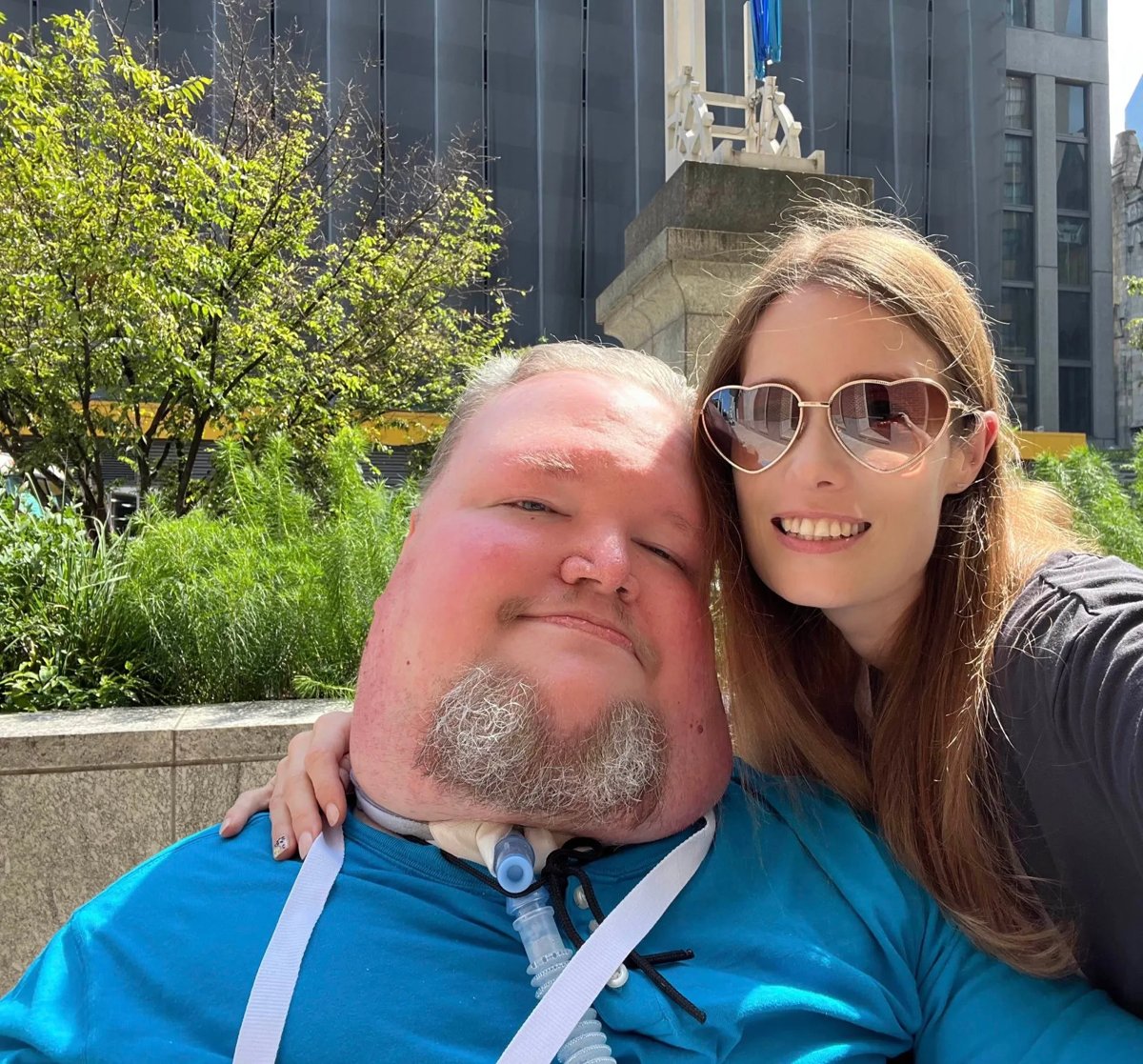 Vicki resting her head beside Steve as they smile together outdoors.
